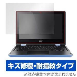 OverLay Magic for Aspire R 11 液晶 保護 フィルム シート シール キズ修復 耐指紋 防指紋 コーティング