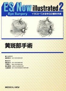 黄斑部手術 イラストでみる今日の眼科手術２／樋田哲夫(編者),大橋裕一(編者),桑山泰明(編者),大鹿哲郎(編者)