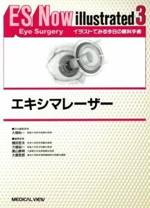 エキシマレーザー ＥＳ　Ｎｏｗ　ｉｌｌｕｓｔｒａｔｅｄｎｏ．３イラストでみる今日の眼科手術３／メディカル