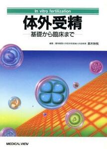 体外受精　基礎から臨床まで／鈴木秋悦(著者)