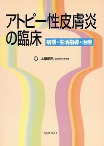 アトピー性皮膚炎の臨床 病態・生活指導・治療／上原正巳(著者)