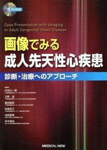 画像でみる成人先天性心疾患　診断・治療へのアプローチ／丹羽公一郎(著者),立野滋(著者)