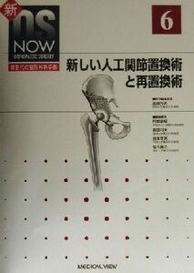 新しい人工関節置換術と再置換術 新ＯＳ　ＮＯＷｎｏ．６新世代の整形外科手術Ｎｏ．６／高岡邦夫(編者)