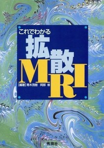 これでわかる拡散ＭＲＩ／青木茂樹(著者),阿部修(著者)