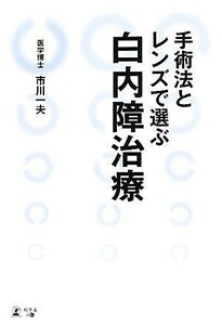 手術法とレンズで選ぶ白内障治療／市川一夫【著】