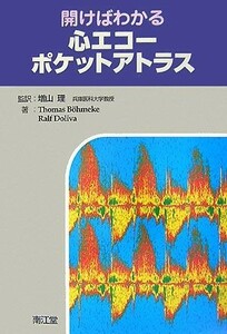 開けばわかる心エコーポケットアトラス／増山理【監訳】，ＴｈｏｍａｓＢ¨ｏｈｍｅｋｅ，ＲａｌｆＤｏｌｉｖａ【著】