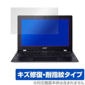 Chromebook 311 CB3119HT 保護 フィルム OverLay Magic for Acer Chromebook 311 CB311-9HT キズ修復 耐指紋 防指紋 コーティング エイサー