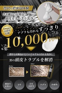 スカルプ 炭酸シャンプー