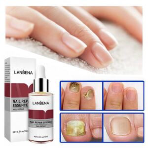 LANBENA ネイルリペアエッセンス 2個セット