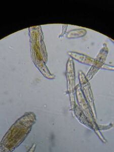 ワムシ、ゾウリムシ #7　稚魚、針子の生き餌　顕微鏡確認発送　　