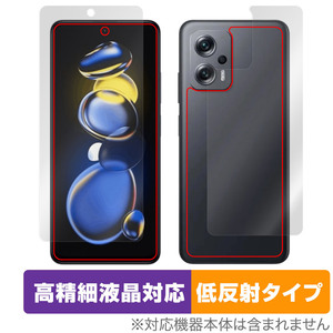 Xiaomi Redmi Note 11T Pro＋ 表面 背面 フィルム セット OverLay Plus Lite for シャオミ レドミノート 11Tプロ＋ アンチグレア 反射防止