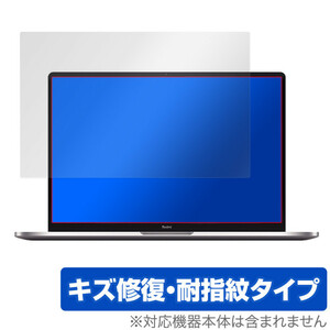 Xiaomi RedmiBook Pro 14 保護 フィルム OverLay Magic for Xiaomi RedmiBook Pro 14 キズ修復 耐指紋コーティング レドミブック プロ