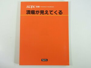 潰瘍が見えてくる SCOPE別刷 日本アップジョン株式会社 1987 大型本 医学 医療 治療 病院 医者 胃潰瘍 消化性潰瘍 エタノール法 ほか