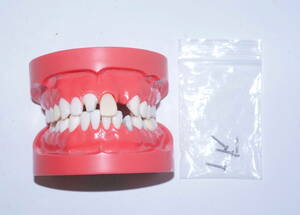NISSIN 歯科 模型 顎模型 歯科衛生士 ニッシン スケーリング スケーラー SRP 歯石 マネキン 超音波 ペリオ 舌