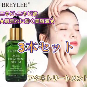 BREYLEE アクネトリートメント ニキビ・肌荒れ美容液 3本