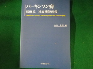 ■パーキンソン病　報酬系,神経機能画像　山本光利　中外医学社　2007年■FASD2022052405■