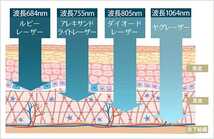 最新次世代機器【IPL&SHR＆Elightのトリプル脱毛＋RFフォト＋RF＋YAGレーザー（シミ,毛穴）】業界初機能搭載！エステ以上を求めるサロン様_画像9