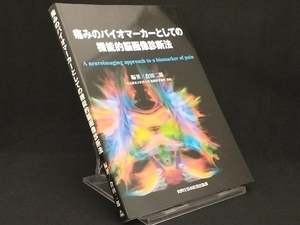 痛みのバイオマーカーとしての機能的脳画像診断法 【倉田二郎】