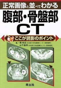 正常画像と並べてわかる腹部・骨盤部ＣＴ　ここが読影のポイント／扇和之(著者),山下晶祥(著者)