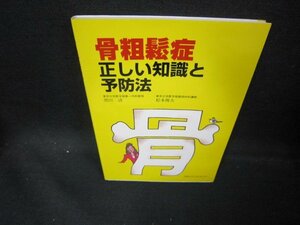 骨粗鬆症　正しい知識と予防法/EAQ