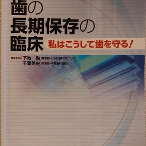 歯の長期保存の臨床　私はこうして歯を守る！