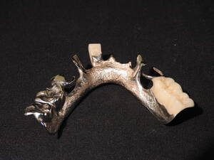 ◆ 銀歯 ブリッジ 約10.7g / 金歯 金パラ 銀パラ パラジウム 被せ物 クラウン 歯科材料