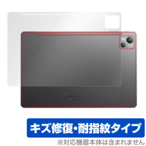 Blackview Tab 13 背面 保護 フィルム OverLay Magic for ブラックビュー タブレット Tab13 本体保護フィルム 傷修復 指紋防止