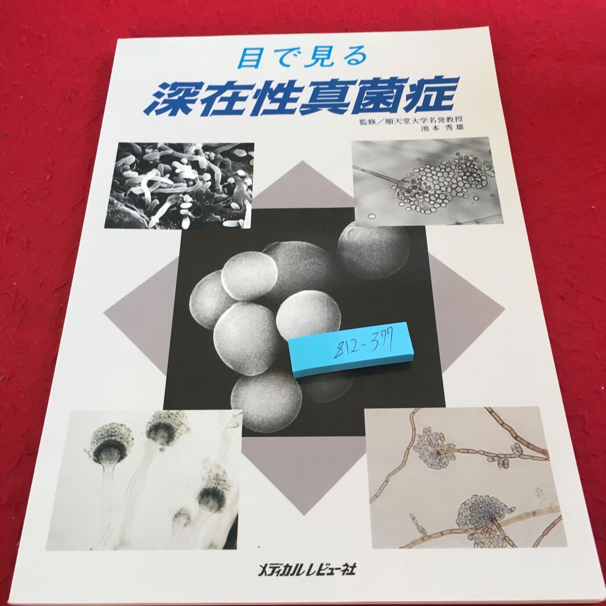 2023年最新】Yahoo!オークション -#真菌症の中古品・新品・未使用品一覧