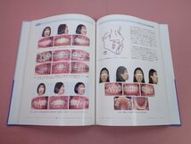 ★初版『 実践 インプラント固定による矯正歯科治療 』山本照子 宮脇正一/訳 砂書房_画像2