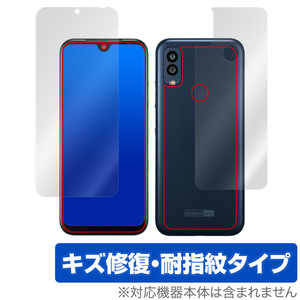 Android One S10 表面 背面 フィルム OverLay Magic 京セラ スマートフォン Android One S10 表面・背面セット 傷修復 耐指紋 指紋防止