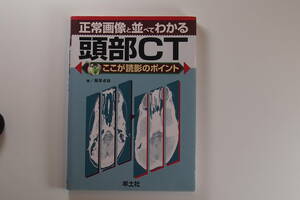 中古本■正常画像と並べてわかる　頭部CT ここが読影のボイント■藤原卓哉著■羊土社