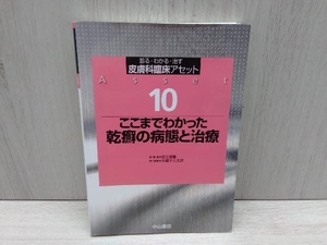 ここまでわかった乾癬の病態と治療　大槻マミ太郎　診る・わかる・治す　皮膚科臨床アセット10　中山書店