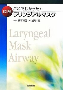 これでわかった！図解ラリンジアルマスク／安本和正【監修】，浅井隆【著】