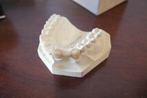 ○歯型模型　臼歯と前歯の型　大量セット　歯医者さんの道具　理科室　レトロ　学校　ヴィンテージ　古道具のgplus広島 2302i_画像5