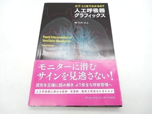 え!?ここまでわかるの?人工呼吸器グラフィックス 竹内宗之 メディカル・サイエンス・インターナショナル 店舗受取可