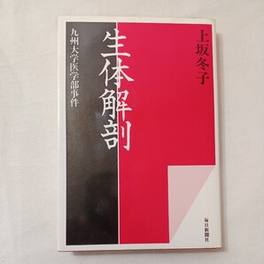 zaa-432♪生体解剖―九州大学医学部事件 上坂 冬子(著) 単行本 (ハードカバー) 1980/04/15 毎日新聞社