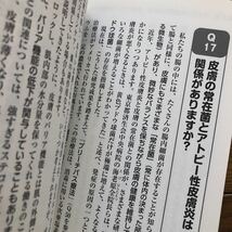 アトピー 皮膚とアレルギーの名医が教える最高の治し方大全 かゆみじんましん 肌のカサカサジュクジュクブツブツ_画像7