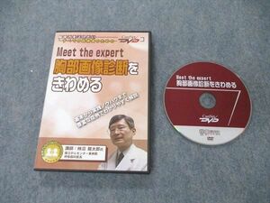 UA06-009 ケアネット Meet the expert 胸部画像診断をきわめる 2003 DVD1巻 柿沼龍太郎 15s3C