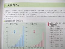 UB27-163 社会保険出版社 生活習慣病のしおり データで見る生活習慣病 2018 10S4A_画像4