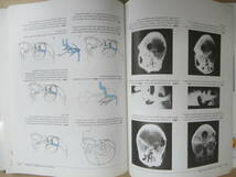 J06●Thieme Color Atlas of Microneurosurgery 3冊＋他2冊 計5冊セット 洋書 医学書 微小神経外科 カラーアトラス 頭蓋神経 230322_画像9
