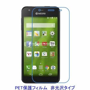 【2枚】 Kyocera Digno C 404KC S301 Digno U 液晶保護フィルム 非光沢 指紋防止 F292