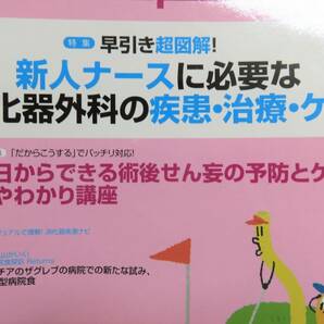 ★平成の品★【 2014・1・5・6・8  MC メディカル出版  消化器外科 NURSING   4冊  】 ★最安送料185円で発送可！  の画像5