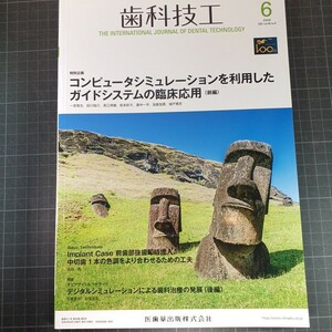 歯科技工　2021年6月号　コンピュータシミュレーションを利用したガイドシステムの臨床応用