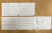 日本光電 心電計 小型 動作確認済み(詳細は商品説明参照) バッテリー動作 12誘導 医療用 印刷可 付属品一式 医師 動物 病院 検査技師 診療_画像6