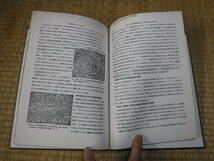 リッチ著　結核の病理発生論（上1，2、下1，2，3）5冊　複製本　岩波書店_画像6