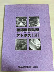 腹部画像診断 アトラス XI 2008 腹部放射線研究会/泌尿器/消化管/盲腸/腹膜/胆道/膀胱子宮内膜症/石灰化胃癌/虫垂原発/医療/医学/B3220716