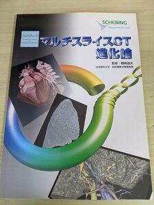 マルチスライスCT 進化論 2004/肺動脈血栓塞栓症/食道癌/大腸脂肪腫/泌尿生殖器/急性心筋梗塞/閉塞性血栓血管炎/高安病/医学/医療/B3220643