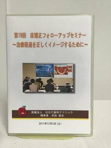 【第19回 床矯正フォローアップセミナー】DVD★症例検討 側拡大したいが3のスペースが足りない 12歳を過ぎた開咬について 他★歯科