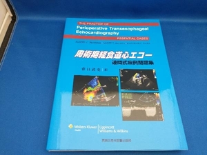 周術期経食道心エコー連問式症例問題集 春日武史【管B】