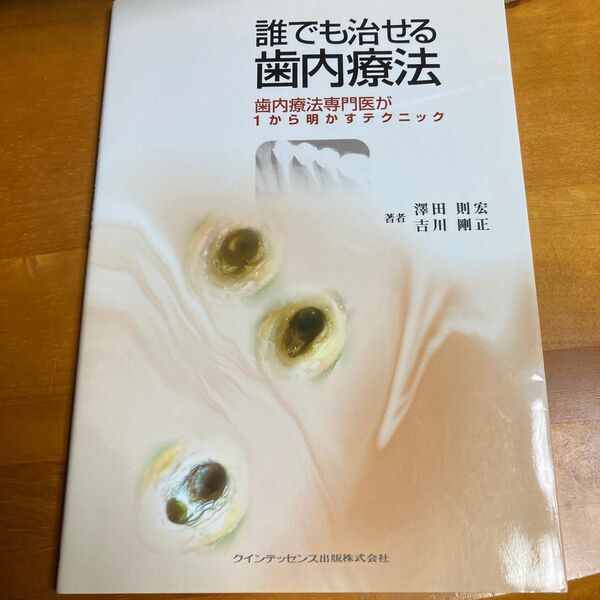 誰でも治せる歯内療法　歯内療法専門医が１から明かすテクニック 沢田則宏／著　吉川剛正／著